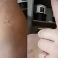 Mãe agredida por filho autista pede socorro para tratar garoto em Catu imagem