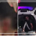 Mulher tem pedaço da orelha arrancado após mordida de marido imagem