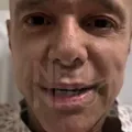 Netinho deve receber alta nesta semana imagem