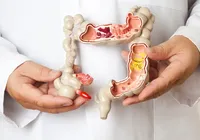 Câncer colorretal: cirurgia robótica revoluciona tratamento imagem