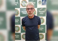 Chefe do TCP é preso em clínica de estética durante harmonização facial imagem