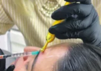 Cuidados no uso do botox evitam perda de dinheiro e problemas de saúde imagem