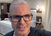 Eduardo Costa surge completamente careca e decide revelar o motivo