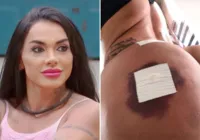 Ex de Tony Salles corrige bumbum após hidrogel: "Tá lindo" imagem
