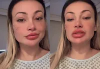 Fortuna? Andressa Urach revela quanto gastou com três dias de internação imagem