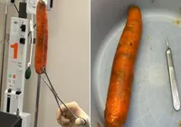 Homem introduz cenoura no ânus e médico faz apelo: "Parem!" imagem