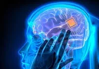 Implante cerebral de mulher transforma seus pensamentos em fala imagem