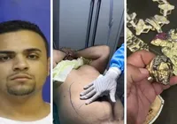 Líder do CV no Rio passou por lipo e tirou bala da cabeça em casa