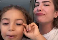 Liz Improta leva tombo, fica com olho roxo e preocupa Lore imagem
