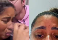 MC Loma passa perrengue em hotel durante viagem internacional