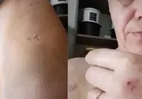 Mãe agredida por filho autista pede socorro para tratar garoto em Catu imagem