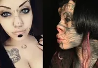 Mulher amputa parte do nariz para ficar parecida com uma gata imagem