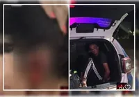 Mulher tem pedaço da orelha arrancado após mordida de marido imagem