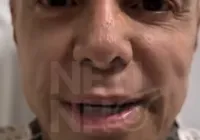 Netinho deve receber alta nesta semana imagem