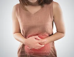 Câncer de intestino: conheça os principais sintomas e prevenções - Imagem