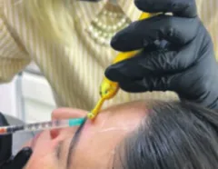 Cuidados no uso do botox evitam perda de dinheiro e problemas de saúde - Imagem