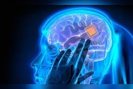 Implante cerebral de mulher transforma seus pensamentos em fala - Imagem
