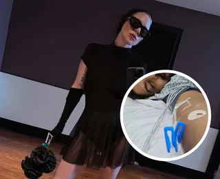 Amor de fã: jovem foge da UTI para ver Lady Gaga em Copacabana