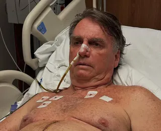 Após uma semana internado, Bolsonaro mostra pontos no abdômen