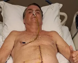 Boletim: Bolsonaro tem quadro de saúde atualizado