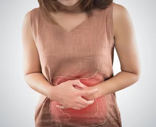 Câncer de intestino: conheça os principais sintomas e prevenções