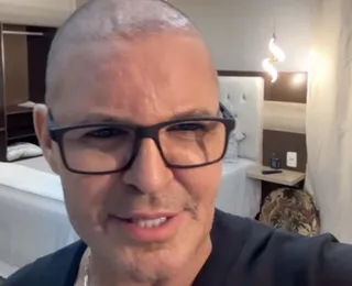 Eduardo Costa surge completamente careca e decide revelar o motivo