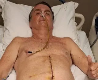 Justiça procura Bolsonaro na UTI para informar sobre julgamento