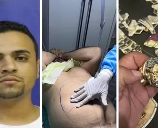 Líder do CV no Rio passou por lipo e tirou bala da cabeça em casa