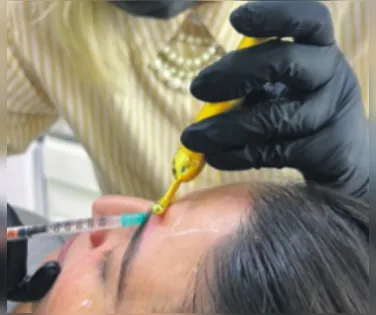 Cuidados no uso do botox evitam perda de dinheiro e problemas de saúde - Imagem