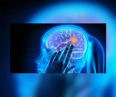 Implante cerebral de mulher transforma seus pensamentos em fala - Imagem