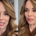 Ana Furtado revela estado de saúde após acidente grave: "Dói muito" imagem