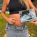 Atleta engravida usando DIU e explica riscos do método imagem