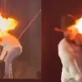 Sertanejo se acidenta e queima rosto durante show imagem