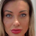 Vídeo mostra detalhes da cirurgia de Andressa Urach nos olhos; assista imagem