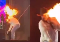 Sertanejo se acidenta e queima rosto durante show