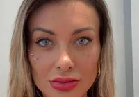 Vídeo mostra detalhes da cirurgia de Andressa Urach nos olhos; assista imagem