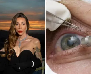 Maya Massafera muda cor dos olhos e médica alerta para risco de cegueira