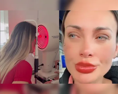Andressa Urach pode ficar cega? Médica alerta sobre risco - Imagem