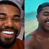 Davi Brito cede a críticas e troca lente de contato dos dentes - Imagem