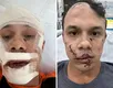 Homem que agrediu personal trainer com copo de vidro é identificado - Imagem