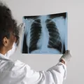 Agosto Branco alerta para prevenção ao câncer de pulmão imagem