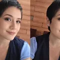 Cirurgia para curar depressão? Mulher relata melhora após intervenção imagem