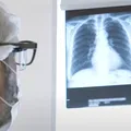 Doenças respiratórias: Bahia registra mais de 5 mil mortes este ano imagem