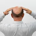 É dos carecas que elas gostam mesmo? Pesquisa responde imagem