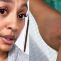 Ela está bem? Sheron Menezzes revela acidente impressionante imagem