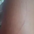 Garota de programa é vítima de estupro e pula de carro para fugir imagem