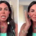 Gretchen mostra rosto pela primeira vez após nova harmonização facial imagem