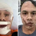 Homem que agrediu personal trainer com copo de vidro é identificado imagem