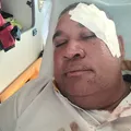 Motorista de ônibus é agredido com marteladas na cabeça em Salvador imagem