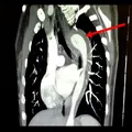 Mulher rompe a aorta durante o sexo e é internada com risco de morte imagem
